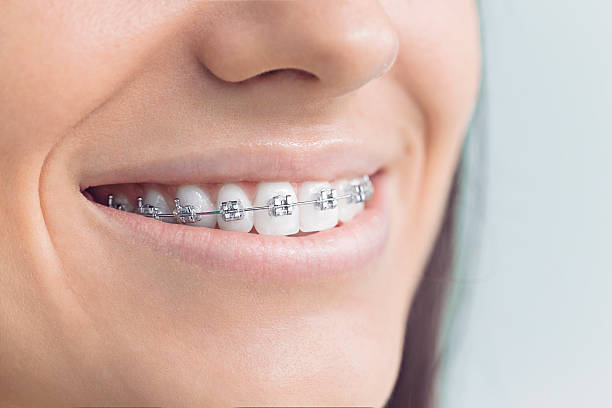 Best Teeth Whitening  in Lacon, IL